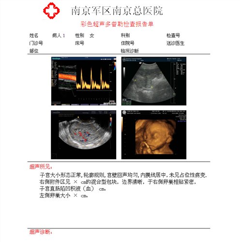超声科胶片 干式热敏胶片 喷墨胶片 菲力姆供-- 合肥菲力姆科技有限公司